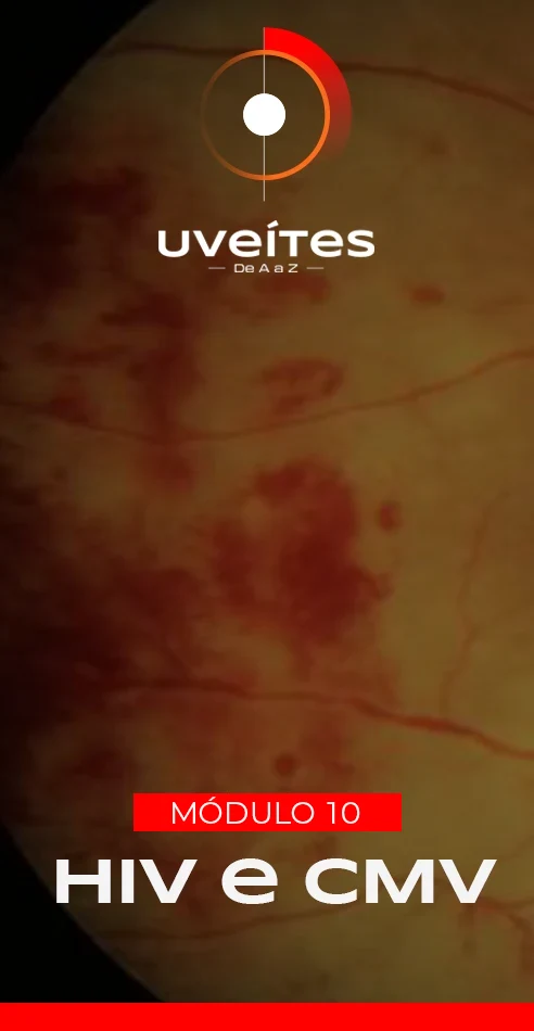Capas_Aulas_Uveites_V10_2