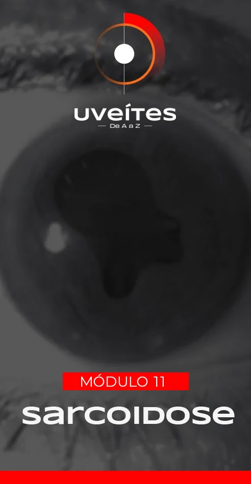 Capas_Aulas_Uveites_V11_2