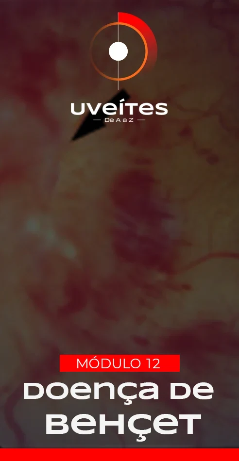 Capas_Aulas_Uveites_V12_2