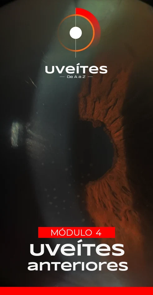 Capas_Aulas_Uveites_V4_2