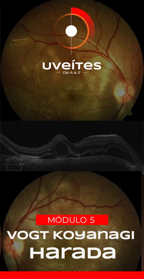 Capas_Aulas_Uveites_V5_2