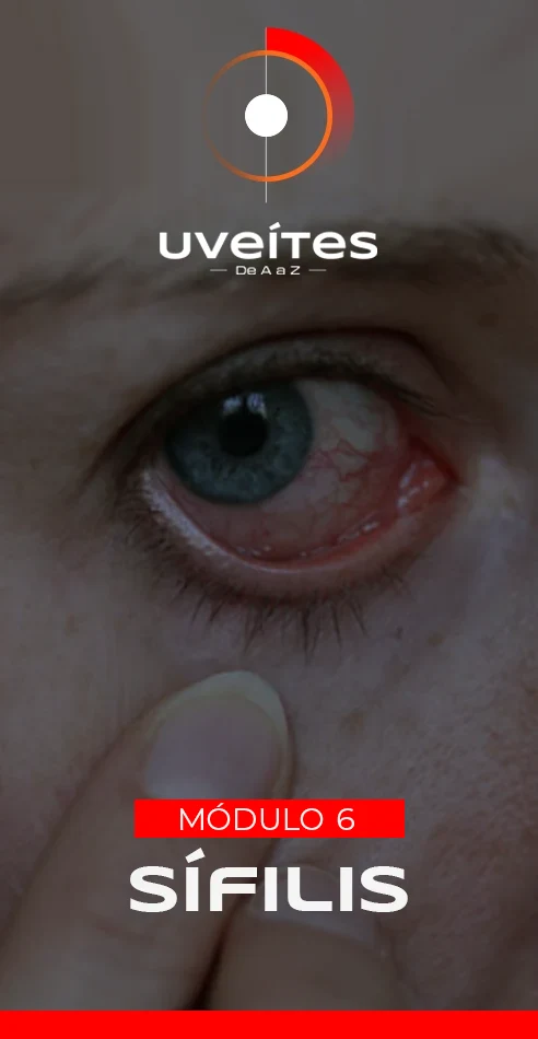 Capas_Aulas_Uveites_V6_2