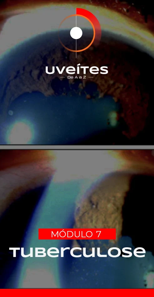 Capas_Aulas_Uveites_V7_2