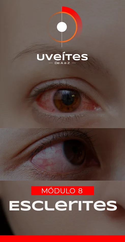 Capas_Aulas_Uveites_V8_2