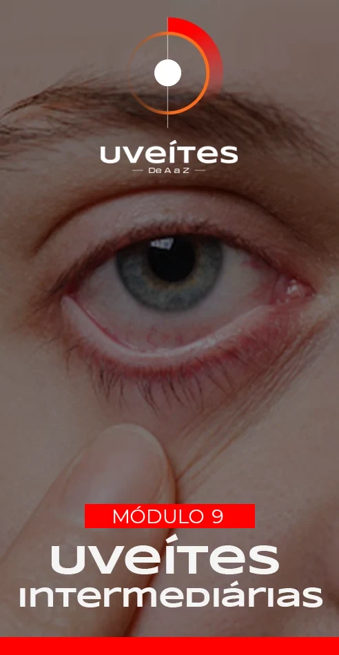 Capas_Aulas_Uveites_V9_2