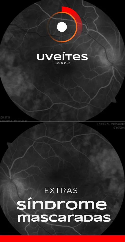 Capas_Aulas_Uveites_VE1