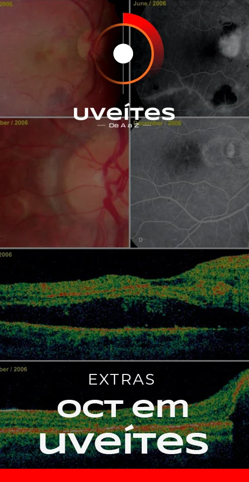 Capas_Aulas_Uveites_VE3