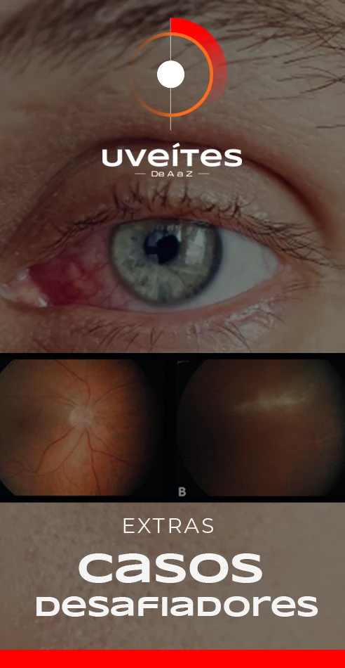 Capas_Aulas_Uveites_VE4