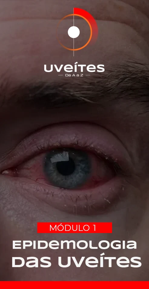 Capas_Aulas_Uveites_v1_2