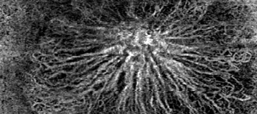 IMG_Orbit_DMRI